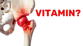 The Miracle VITAMIN That Heals SICK HIPS [upl. by Legyn748]