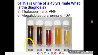 Haematology OSPE Part 2 [upl. by Eisso]