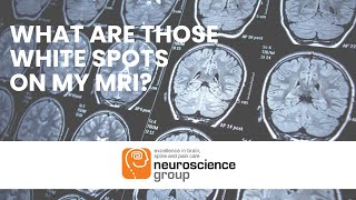 What are the white spots on my MRI [upl. by Nilknarf]