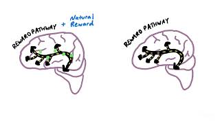 How an Addicted Brain Works [upl. by Roch]