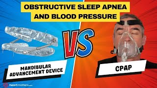 Obstructive Sleep Apnea amp Blood Pressure  Mandibular Advancement Device Vs CPAP [upl. by Dallman]