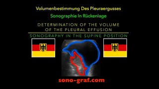 Sonographie  Bestimmung des Volumens des Pleuraergusses in Rückenlage [upl. by Rimaa]