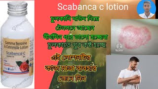 Gamma benzene cetrimideScabanca lotion চুলকানির ক্ষেত্রে ব্যবহার করা হয় scabanca lotion [upl. by Hammad16]