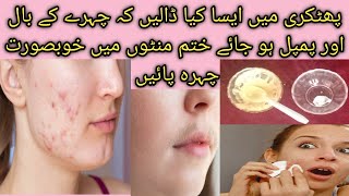 acne pimple removal at home for boy and girl hair remove from face permanently [upl. by Hennebery674]