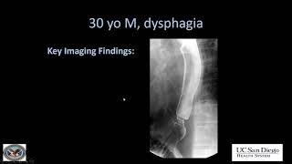 Imaging of esophagus [upl. by Laroc334]