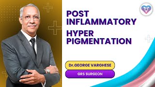 What is Post Inflammatory Hyper Pigmentation What are its treatment options [upl. by Torre]