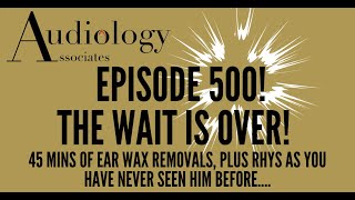 45 MINS OF EAR WAX REMOVALS WITH A TWIST  EP500 [upl. by Aisatna939]