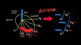 CURSO DE ELECTROCARDIOGRAFIA 34  CAMBIOS EN EL VECTOR INICIAL DEL QRS [upl. by Attennek]