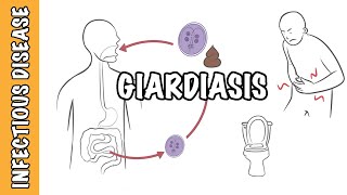 Giardiasis  Giardia Lamblia Giardia intestinalis Giardia duodenalis infection [upl. by Schnorr]