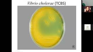 Microbiology  Lecture 8  Vibrio  Aeromonas  Campylobacter [upl. by Alaj]