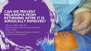 Can We Prevent Melanoma From Returning After It Is Surgically Removed [upl. by Aliahs]