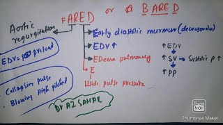 Mnemonic for Aortic Regurgitation with mcqs [upl. by Launamme]