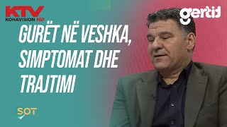 Gurët në veshka simptomat dhe trajtimi [upl. by Marlin]