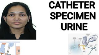 Catheter specimen urine NMC OSCECatheter specimen collection [upl. by Rolfe]