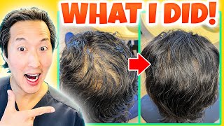 How I Treated My Thinning Hair the Holistic Way [upl. by Bradman]