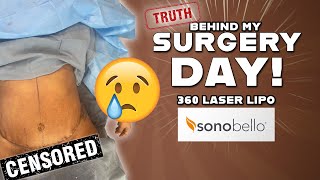 The Truth Behind My Surgery Day  Sono Bello Laser Lipo  Before and After  I CRIED [upl. by Salta]