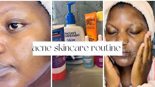 Affordable Skincare Routine For Acne and Dark marks [upl. by Keeley]