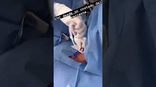 How to place central Venous catheterCVC cvc medicalpedicure ivline intravenousinjection docto [upl. by Ehcnalb623]