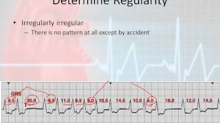 Basic Rhythm Interpretation parr 5  The Systematic Approach 3 [upl. by Attebasile983]