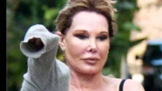 Jocelyn Wildenstein New Face After Plastic Repair Surgery [upl. by Red]