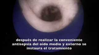 Perforación de tímpano Imágenes médico veterinarias [upl. by Alexandre2]