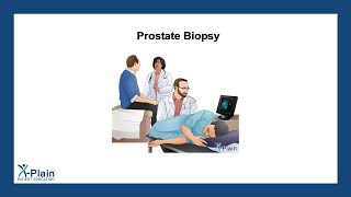 Prostate Biopsy [upl. by Modestia639]