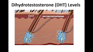 DHT  Dihydrotestosterone  How to naturally balance your hormones [upl. by Jere554]