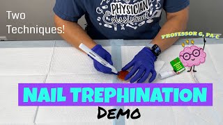 Nail Trephination on Homemade Demo [upl. by Alesi649]