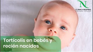 Tortícolis en bebes y niños recién nacidos 👶🏻 Fisioterapia Pediátrica Gijón Asturias [upl. by Clayborne]