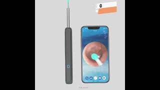 Ear Cleaner Otoscope Ear Wax Removal Tool With Camera LED Light Wireless Ear Endoscope Ear Clean [upl. by Shoemaker75]