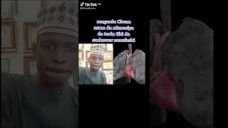 maganin Ciwan asma da nimoniya da tarin tibi da sarkewar numfashi Dr Hamisu Nura Salihu mai karama [upl. by Cindra824]