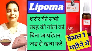 Lipoma  1 महीने में लिपोमा चर्बी की गांठ को जड़ से ठीक करें  Homeopathic Treatment of Lipoma [upl. by Barker]