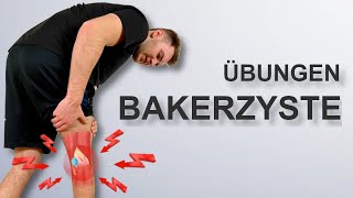 Schmerzen in der Kniekehle Bakerzyste  Soforthilfe [upl. by Aerdnu]