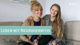 Leben mit Neurodermitis  Krankheit ist keine Ausrede mit Lydia Zauberhaut  SST010 [upl. by Aesoh]