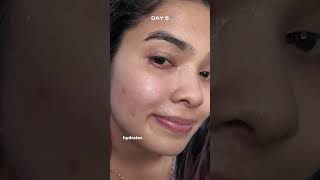 I applied rice water on my face for 7 days challenge trendingonshorts [upl. by Mima]