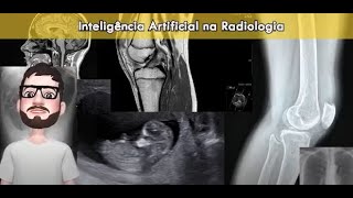 Inteligência Artificial em Radiologia [upl. by Aksel]