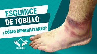 ESGUINCE DE TOBILLO ¿Qué es y cómo rehabilitarlo [upl. by Brien199]