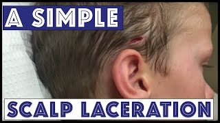 A Sunday Scalp Laceration [upl. by Enwad]