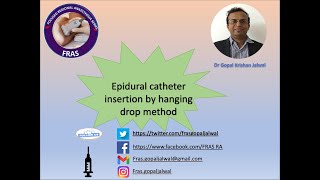 Epidural catheter insertion by hanging drop method [upl. by Lemert]