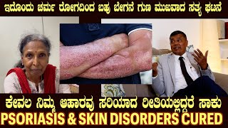 Live Story of PSORIASIS cured by Food as Medicine by Dr S M Raju IAS Rtd [upl. by Alon]