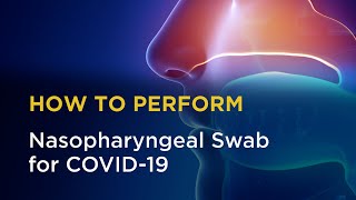 Nasopharyngeal Swab for COVID19 [upl. by Ron]