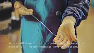 IVC Filter Placement [upl. by Jerome]