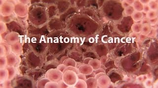 What Is Cancer What Causes Cancer amp How Is It Treated [upl. by Lerred258]