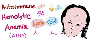 Autoimmune Hemolytic Anemia AIHA  Warm autoantibodies IgG  Hematology [upl. by Nodababus]