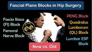 Which Fascial Plane Blocks in Hip Surgery 2022 [upl. by Otnas]