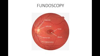 HOW TO DO FUNDOSCOPY OR OPHTHALMOSCOPY [upl. by Tuchman]