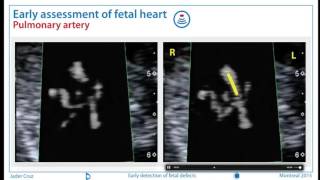 ISUOG 2015 Satellite Symposium  Picture Perfect [upl. by Iramo]