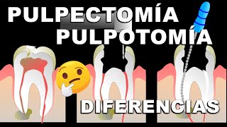 ⚠️ Procedimiento DENTAL en niños con caries muy profundas 📣 [upl. by Jacobsen]