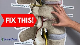 How to Fix a Bulging Disc in Your Lower Back  RELIEF IN SECONDS [upl. by Ococ510]