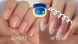 Easiest ways to grow your nails in just 7 days  Hacks to grow your nails faster [upl. by Semajwerdna116]